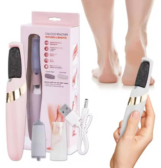 Removedor de Callos – ¡Pies suaves en minutos! 👣