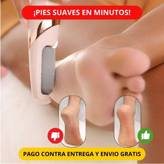 Removedor de Callos – ¡Pies suaves en minutos! 👣