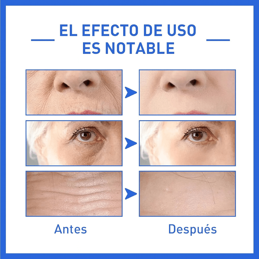 Botox Facial x 2 Frascos – Efecto Tensor Inmediato