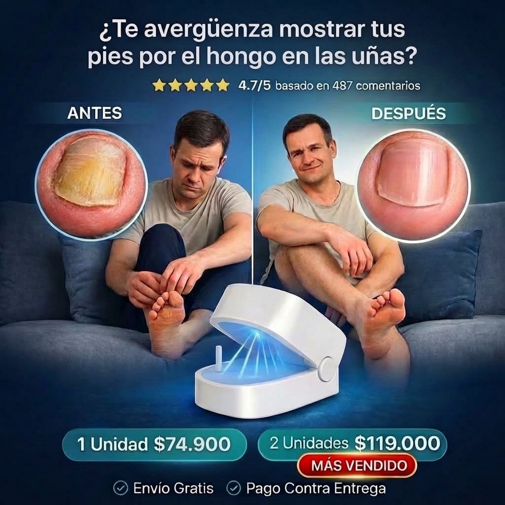 LaserNail - Tecnologia Anti-Hongos